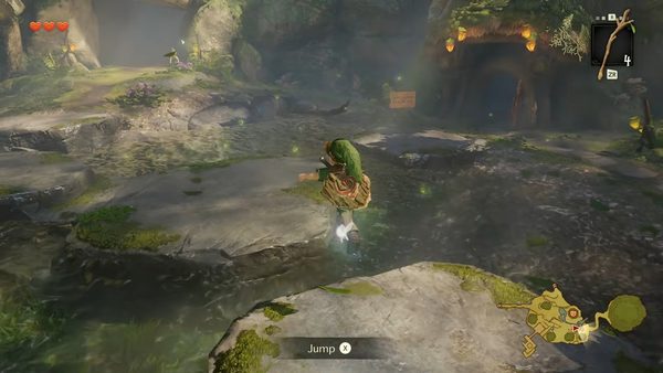The Legend of Zelda: Ocarina of Time Remake 8 Young Link using the new manual jump ability in Kokiri Forest in The Legend of Zelda: Ocarina of Time Remake